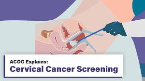 Image result for Cervical Cancer Screening