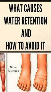 what causes water retention and how to avoid it water retention water retention remedies health