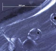 The histology of compact bone. Bone Histological Analysis Springerlink