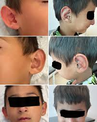 Dr Abrego Diego Uriel (@drabregodiegouriel) • Instagram photos and videos