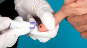 It is important to note that serious adverse events, including deaths that are unrelated to the vaccine are. Koronavirus Gyorsteszt Szerologiai Vizsgalat