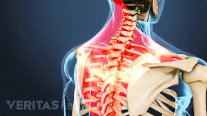 These muscles are also called immigrant muscles, since they actually represent muscles of the upper limb ﻿ that have migrated to the back during fetal development. Common Causes Of Back Pain And Neck Pain