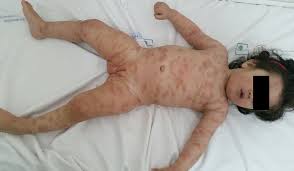 The Pan African Medical Journal Image Quiz