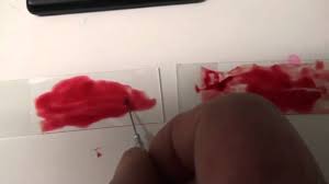 Irritation or inflammation can cause blood to be produced from the larynx, trachea or lungs. Dog Breathing Hard And Coughing Up Blood D Con Poisoning Youtube