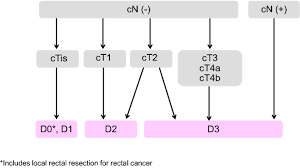 In this case, knowing the signs is crucial. Japanese Society For Cancer Of The Colon And Rectum Jsccr Guidelines 2019 For The Treatment Of Colorectal Cancer Springerlink