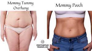 When you develop muscles in the lower abdomen and lose weight all over the body, it will force the body to start burning fat. Mommy Tummy Overhang 5 Tips To Get Rid Of Your Apron Belly Postpartum Trainer Md