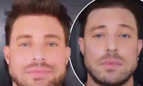 Duncan james is loving life with his hunky boyfriend. Duncan James Reveals He Has Had Filler Injections In His Jaw Daily Mail Online