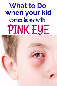 What To Do When Your Kid Comes Home With Pink Eye Natural Pink Eye Remedy Pink Eyes Pinkeye Remedies