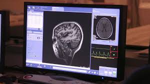How schizophrenia affects the brain. People With Schizophrenia Can Learn To Control Voices Science Tech News Sky News