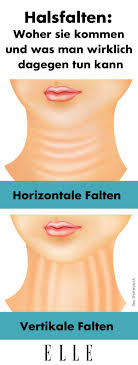 Hast Du Dir Schon Ein Mal Gedanken Um Deine Halsringe Gemacht Woher Sie Kommen Und Ob Sie Schlimmer Werden Oder Ner Gesicht Pflege Hals Doppelkinn Loswerden