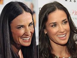 In 2010, moore had addressed rumours of plastic surgery and had denied getting anything done on her face. All Categories Demi Moorena
