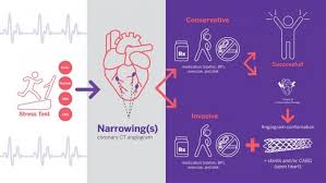 While cardiac arrest can happen to anyone of any age, heart attacks are more likely to occur in men above the age of 45 and. Ischemia Trial Results Find Interventions For Stable Heart Disease No Better Than Drug Therapy Daic
