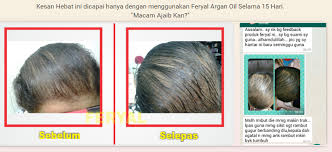 Argan oil feryal shampoo hair treatment new stock feryal hair tonic lulus kkm dan halal dibawa solatferyal scalp and. Adara Beauty Feryal Argan Oil Jojoba Oil