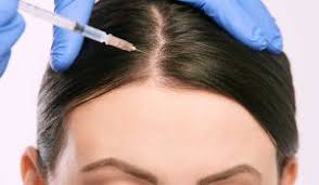 عيادات زراعة الشعر في تركيا 10 مراكز تمنحك خصلات كثيفة موثوق