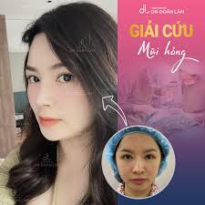 Dr Doãn Lâm: Chuyên gia 'giải cứu' thành công những ca nâng mũi hỏng