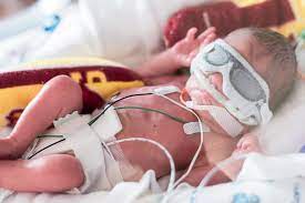 What To Expect From A Baby Born At 32 Weeks Lovetoknow