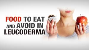 Food To Eat And Avoid In Leucoderma Dr Nitika Kohli Aimil