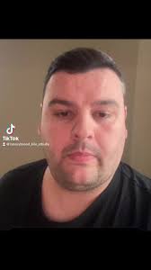 4 months post op and 8 stone down! Its been so hard and i struggle  everyday, you would not believe how much i miss pigging out! I dont this  for myself and my family and its the best desicion ive ever ...