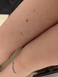 My latest tattoo - Freckle Big Dipper Constellation by Laura at S&S Tattoo  in Edmonton, Alberta : rtattoos