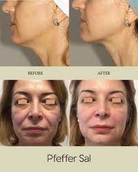 Earlier this week, Pfeffer Sal owner, Barbara, and HUMEN founder,  @riverrhawkins, co-hosted a skin health and wellbeing event at the clinic  with @humenorg in honour of Men's Mental Health week 🧡 As