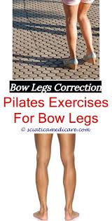 How To Correct Bow Legs At Home Bow Legged Correction Bow Legged Knock Knees