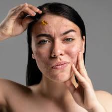The Skin Doctors: Best Dermatologist in Pimple Saudagar, Pune