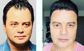 Mas luan santana ficou ainda mais gato com o novo corte de cabelo que ele. Irreconhecivel Cantor Renner Faz Harmonizacao Facial E Se Transforma Sbt