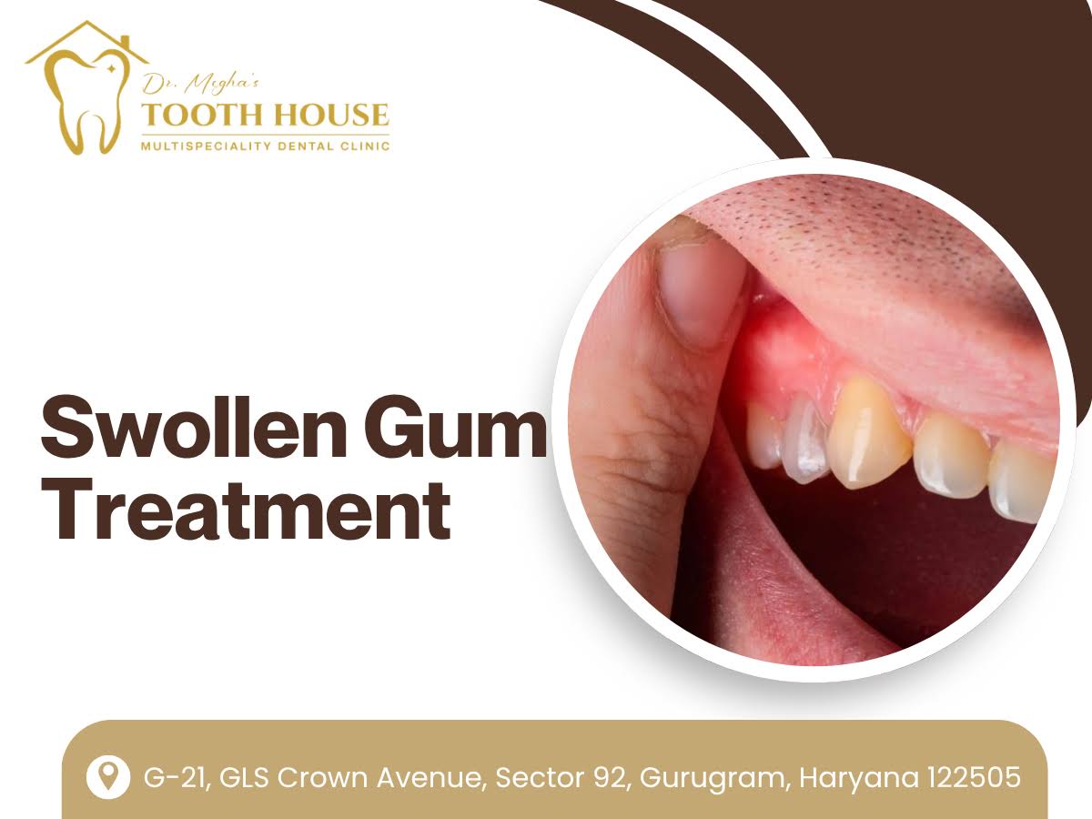 Swollen Gum Treatment product image
