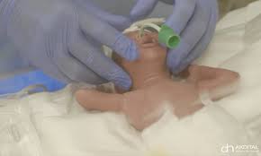 A south african woman has given birth to 10 babies, breaking the world record held by malian woman halima cisse who gave birth to nine children in morocco in may. Pregnant Malian Woman Who Was Expecting Seven Babies Gives Birth To Nine Daily Mail Online