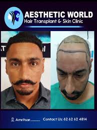 Time to change the look