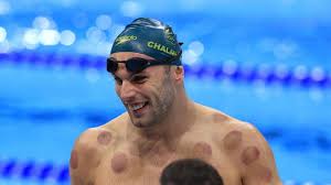 Steven novella on august 10, 2016. Olympics Why Do Athletes Perform Prophetic Hijama About Islam