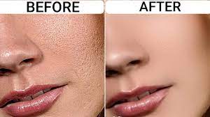 Simply put, uneven skin texture refers to the skin's surface being rough, bumpy, dull, and dry or having irregular grooves and scars. Get Rid Of Uneven Skin Texture For Smooth Glowing Skin K4 Feed