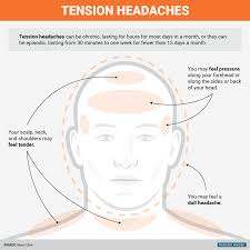 Pin On Head Ache