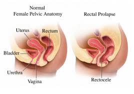 So given that an unbroken hymen isn't a reliable sign of virginity; Hymen Location Pictures Surgery And Repair