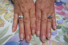 Maybe you would like to learn more about one of these? Covid Nails These Changes To Your Fingernails Can Show If You Ve Had Coronavirus