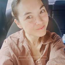 As I approached 40, dark spots and redness became some of my biggest  concerns. I started noticing them more, especially after pregnancy.  Hormonal changes, like melasma, caused dark patches to appear seemingly