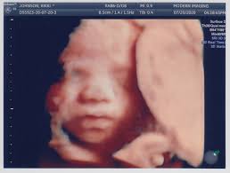 erin and rikki are having a baby