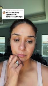 Replying to @notchickpea #curex #allergies