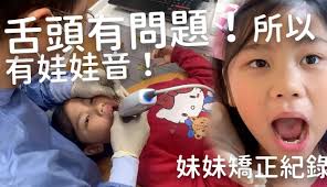 SunnyYummy玩具箱】妹妹会有娃娃音原来是因为舌头的问题？ 医师准备要怎么矫正？-2万粉丝1千作品热议中_生活视频-免费在线观看-爱奇艺