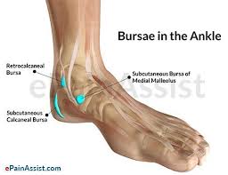 Small well corticated bony fragments lies at the anterior aspect of the medial malleolus. Pin On Ankle Bursa