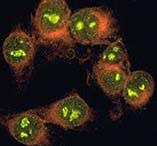 Image result for ANA Staining Pattern