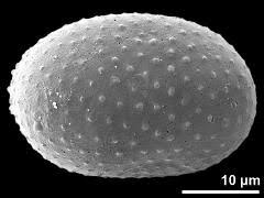 Image result for Stanfieldiella imperforata