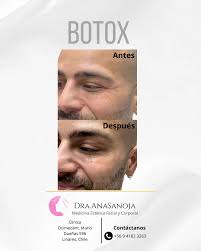 Hidroage💦• Limpieza Facial Profunda en 7 Pasos• Diagnóstico digital por  imágenes, limpia en profundidad , exfolia , hidrata ,nutre. 🧖‍♀️🍃 ¡La  revolución facial llegó a Chile🥇! 📲Contáctanos para una cita a mi