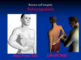 Image result for Lift-Off Subscapularis Test