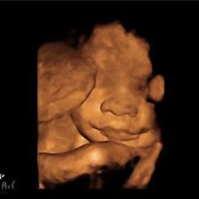 Image result for tbn:T5UajvfpShvp6M::www.photoslinks.com/index.php%3Foption%3Dcom_joomgallery%26func%3Dwatermark%26catid%3D4%26id%3D23%26Itemid%3D2