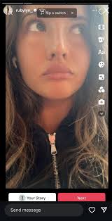 Ruby Lyn nose job : r/NYCinfluencersnark