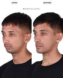 Daniel Roscher Ortognática Maxilofacial