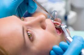 It will provide you with an update on mailing status. Cavity Filling 101 How Long Should You Wait Warren Michigan Dentist Dr Gregory Apsey