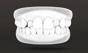 Crossbite what you need to know about transforming your smile with invisalign treatment. Invisalign Aligners For Crossbites Orthodontic Treatment Invisalign Australia