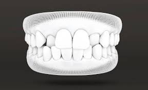 We did not find results for: Invisalign Aligners For Crossbites Orthodontic Treatment Invisalign Australia